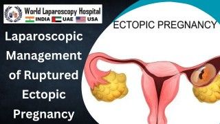 Advanced Precision and Rapid Recovery: Laparoscopic Management of Ruptured Ectopic Pregnancy