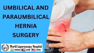 Comprehensive Umbilical and Paraumbilical Hernia Surgery for Optimal Recovery