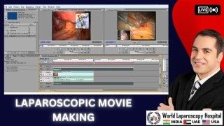 Role of Laparoscopy in Cancer Surgery