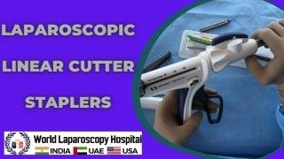 Precision and Efficiency: Laparoscopic Linear Cutter Staplers for Surgical Procedures