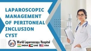 Advancing Surgical Techniques: Exploring Laparoscopic Mastery in Peritoneal Inclusion Cyst Treatment
