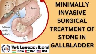 Podcast of World Laparoscopy Hospital