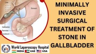 Laparoscopic Nephrectomy