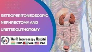 Diagnostic Laparoscopy with Hysteroscopy for infirtility