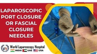 Seamless Closure with Laparoscopic Port or Fascial Closure Needles