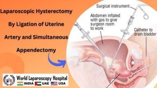 Revolutionizing Hysterectomy: The Power of Unedited Total Laparoscopic Surgery