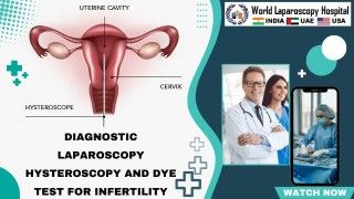 Laparoscopic Surgery For Large Broad Ligament Fibroid