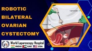 Da Vinci Robotic Surgery for Severe Abdominal Adhesion