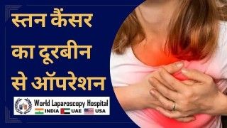 Laparoscopic Surgery For Ovarian Dermoid Cyst