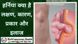 How to Perform Safe Diagnostic Laparoscopy - Lecture by Dr R K Mishra