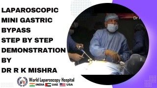 Dr. R K Mishra's Step-by-Step Demonstration of Laparoscopic Mini Gastric Bypass