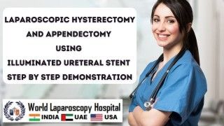 Step-by-step demonstration of laparoscopic hysterectomy and appendectomy illuminated ureteral stent