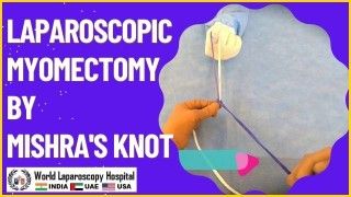 Laparoscopic Myomectomy Using Mishra's Knot Delivers Advanced Minimally Invasive Treatment