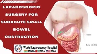 Laparoscopic Surgery Offers Effective Treatment for Subacute Small Bowel Obstruction