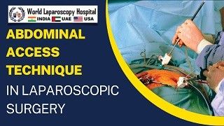 Abdominal Entry Technique in Laparoscopic Surgery