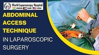 Total Laparoscopic Hysterectomy by Ligation of Uterine artery