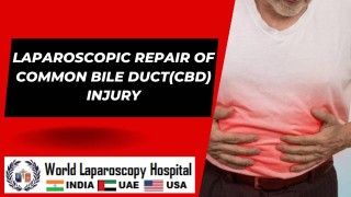 Advancing Surgical Expertise: Laparoscopic Repair of Common Bile Duct (CBD) Injury