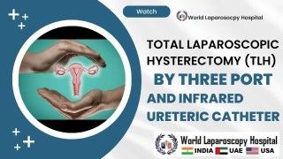 Three-Port Total Laparoscopic Hysterectomy (TLH) with Infrared Ureteric Catheter
