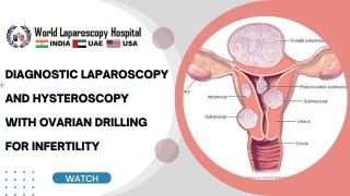 Myomectomy and Dermoid Ovarian Cystectomy