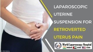 Transforming Lives: Laparoscopic Uterine Suspension for Retroverted Uterus Pain
