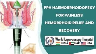 Enhancing Quality of Life: PPH Haemorrhoidopexy for Painless Hemorrhoid Relief and Recovery