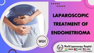 Laparoscopic Endometrioma Treatment: Ultrasonic & H2O2 Therapy