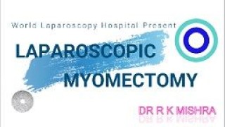 Laparoscopic Myomectomy and Ovarian Cystectomy for Multiple Myomas and Paraovarian Cyst