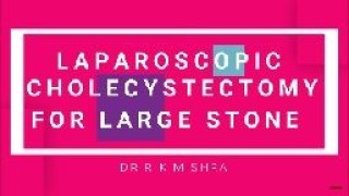 Laparoscopic Roeder's knot demonstration by Dr R K Mishra