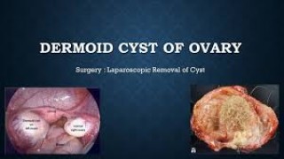 Best Minds in Laparoscopic Surgery: Attend the Sixth World Congress of Laparoscopic Surgeons