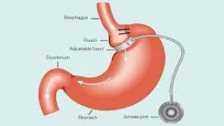 Female Pelvic anatomy and Tubal Patency Test