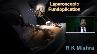 Skin to Skin Total Laparoscopic Hysterectomy with Infrared Ureteric Stent