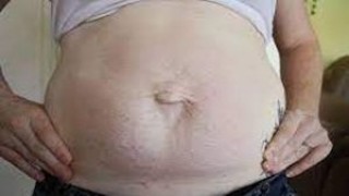 Diploma in Minimal Access Surgery