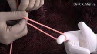 Laparoscopic Varicocelectomy