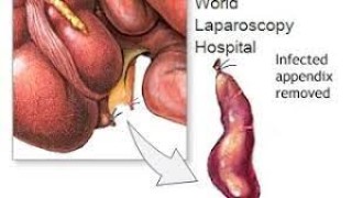 World Laparoscopy Hospital Laparoscopic Fellowship Training Convocation