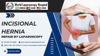 Pediatric Laparoscopy Lecture by Dr R K Mishra