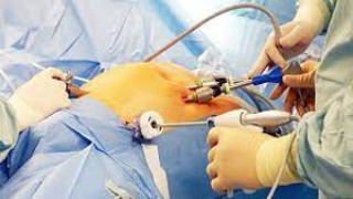Introduction of Minimal Access Surgery lecture by Dr R K Mishra