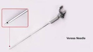 Dr. R.K. Mishra demonstrating Laparoscopic Management of Dermoid Cyst