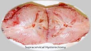 World’s Oldest & Best Laparoscopic Training Institute Since 2001 – WLH