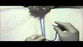 Laparoscopic Heller's Myotomy for Achalasia in Pediatric Patient
