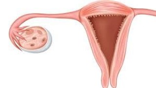 Laparoscopic Surgery for Ovarian Cyst Diseases