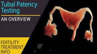Laparoscopic Ovarian Cystectomy and Myomectomy by Dr R K Mishra