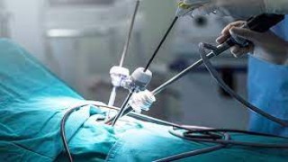 Total Laparoscopic Hysterectomy by Three 5 mm Ports