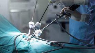 Revitalizing Quality of Life: Advanced Surgical Procedure for Uterine Prolapse Repair