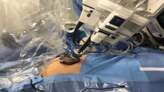 Robotic Surgery at World Laparoscopy Hospital