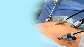 Ipom Inguinal Hernia Surgery by Suturing - Personnel Technique Dr R K Mishra