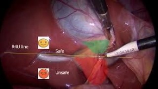 World Laparoscopy Hospital