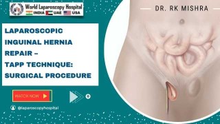 Laparoscopic Inguinal Hernia Repair: TAPP Technique Step-by-Step Surgical Procedure