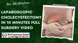 Laparoscopic Cholecystectomy in 10 Minutes – Performed by Dr. R. K. Mishra