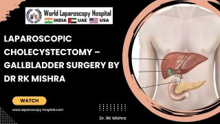 Laparoscopic Cholecystectomy: Complete Guide to Gallbladder Removal Surgery