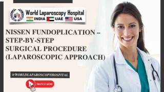 Nissen Fundoplication: Step-by-Step Laparoscopic Procedure Explained